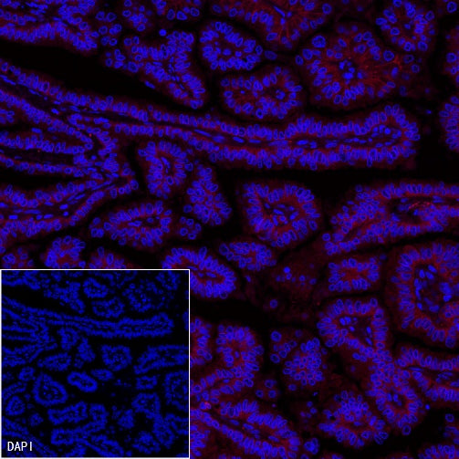 EpCAM Recombinant Rabbit mAb (PE Conjugate) (S-078-13)