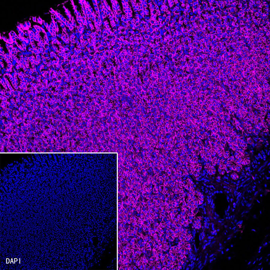 Claudin 18.2 Recombinant Rabbit mAb (Cy5 Conjugate) (SDT-102-24)
