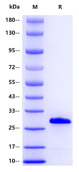 Bcl-xL His Tag Protein, Human