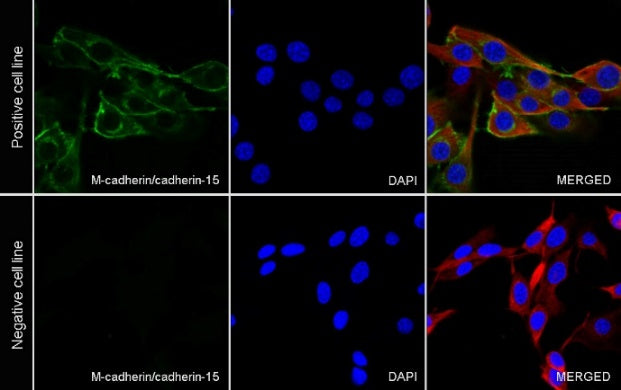 M-Cadherin/Cadherin 15 Recombinant Rabbit mAb (S-2261-74)