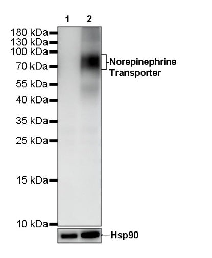 Norepinephrine Transporter Recombinant Rabbit mAb (S-2415-67)