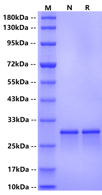 Cardiac Troponins I (cTnI) His Tag, Human