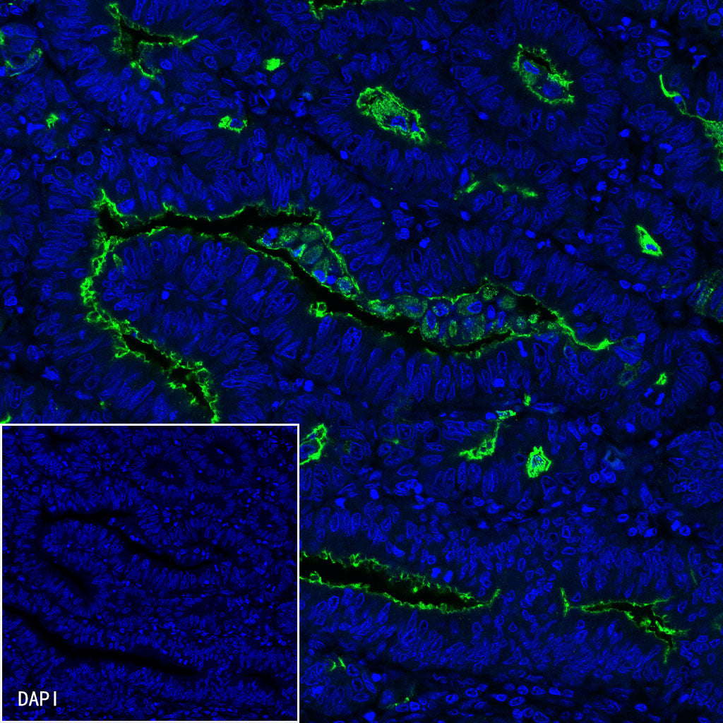 S-RMab® MUC1/EMA Recombinant Rabbit mAb (SDT-776-49)