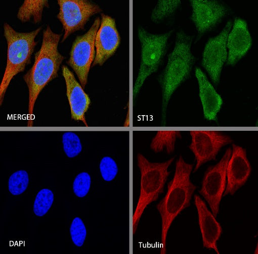ST13 Recombinant Rabbit mAb (S-661-38)