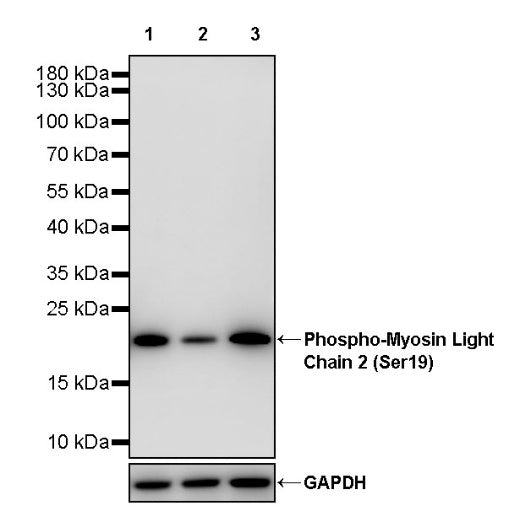 Phospho-Myosin Light Chain 2 (Ser19) Recombinant Rabbit mAb (S-3335-18)