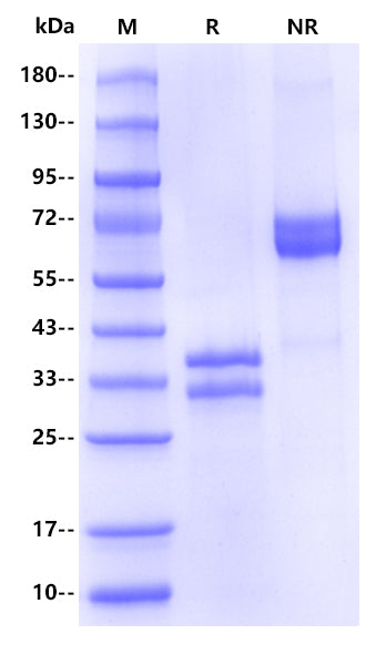 Human CD8 alpha&beta (CD8A&CD8B) Heterodimer Protein, His Tag&Flag Tag