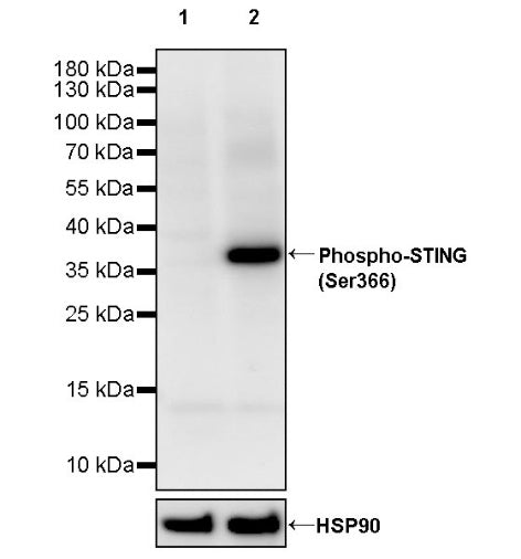 Phospho-STING (Ser366) Recombinant Rabbit mAb (S-2243-62)