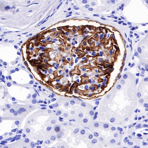 CD35 Recombinant Rabbit mAb (SDT-R224)