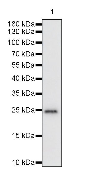 PGP9.5 Recombinant Rabbit mAb (S-R281)