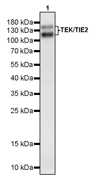 TEK/TIE2 Recombinant Rabbit mAb (S-3846-54)