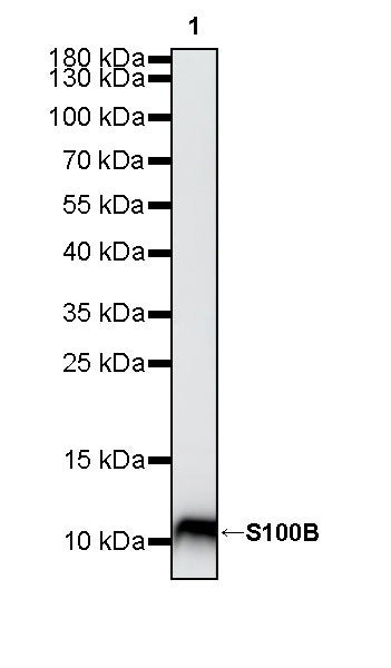 S100B Recombinant Rabbit mAb (SDT-093-108)