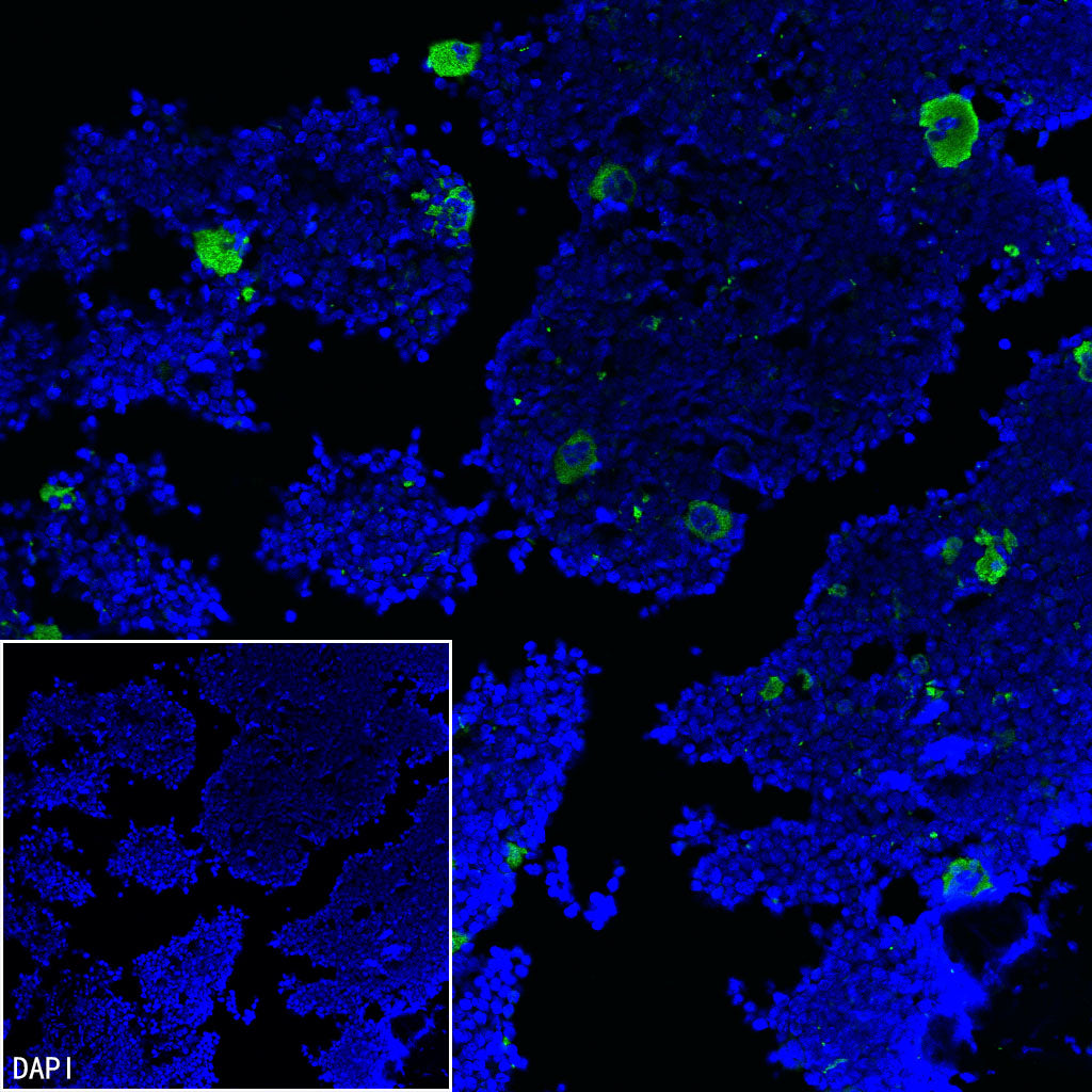 Thrombospondin 1 Recombinant Rabbit mAb (S-4153-22)