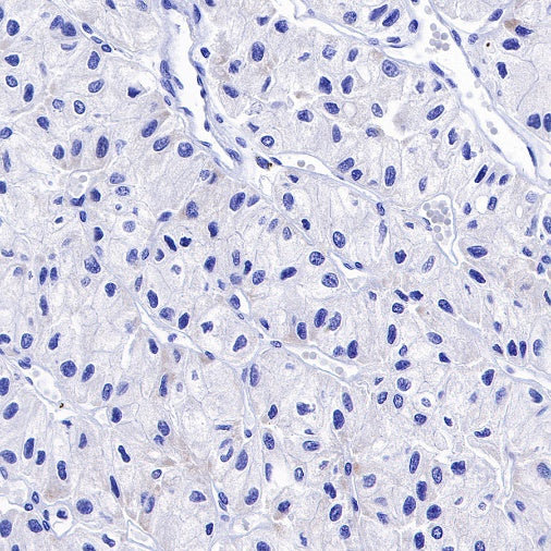 Carbonic Anhydrase 9 Recombinant Rabbit mAb (SDT-733-28)