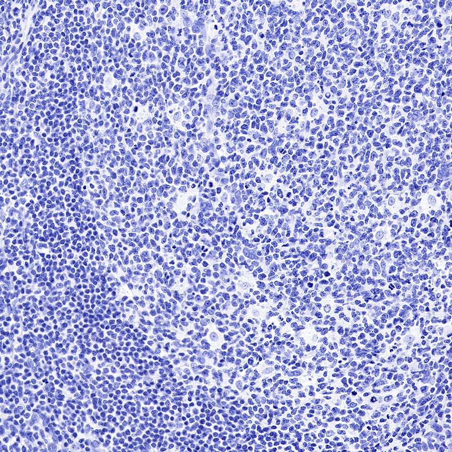 CGA/HCG-α Recombinant Rabbit mAb (SDT-227-66)