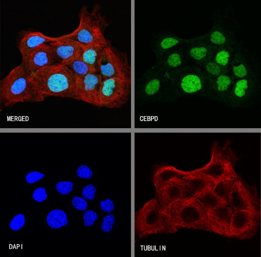 CEBPD Recombinant Rabbit mAb (S-1932-47)