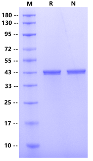 HRSVB(Strain 18537)Nucleoprotein ,His tag Protein