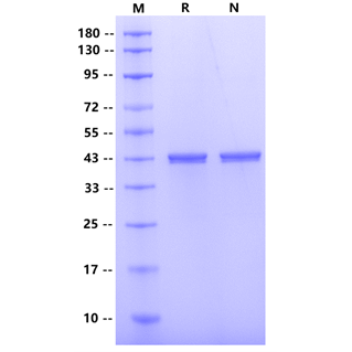 HRSVB(Strain 18537)Nucleoprotein ,His tag Protein