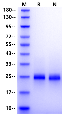 OSM(209aa) Protein, Human
