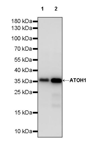 ATOH1 Recombinant Rabbit mAb (S-1301-11)
