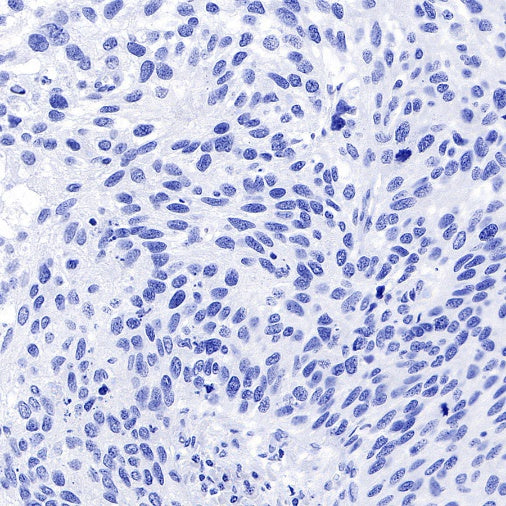 TPO Recombinant Rabbit mAb (SDT-420-57-1)