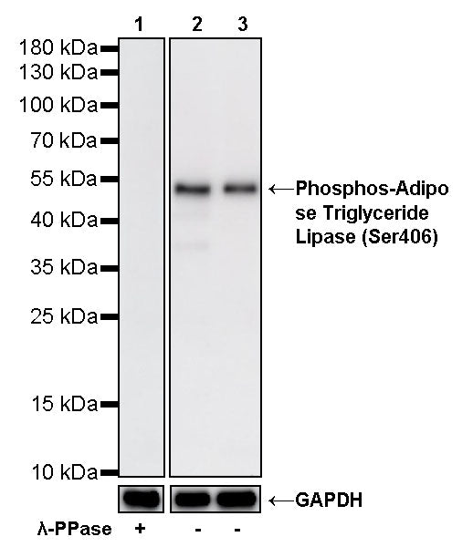 Phosphos-Adipose Triglyceride Lipase (Ser406) Rabbit Polyclonal Antibody