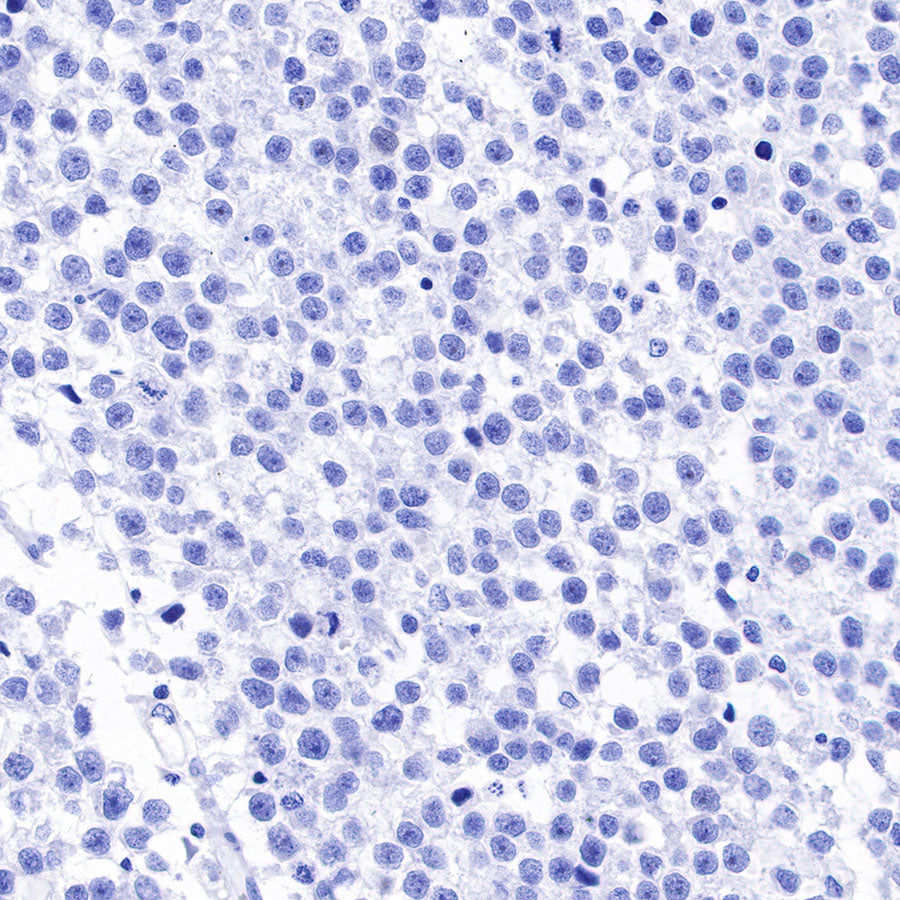 NY-ESO-1 Recombinant Rabbit mAb (SDT-R154)