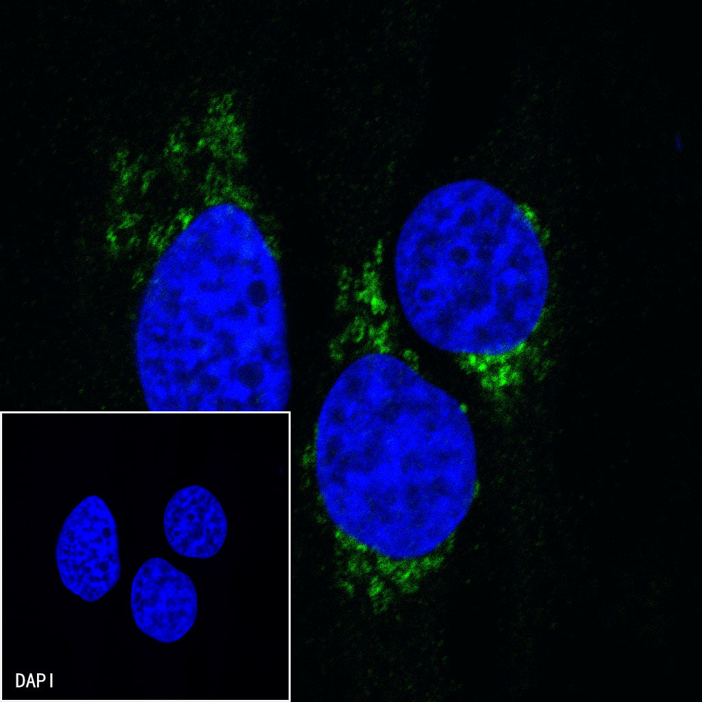 Inhibin alpha Recombinant Rabbit mAb (SDT-R307)