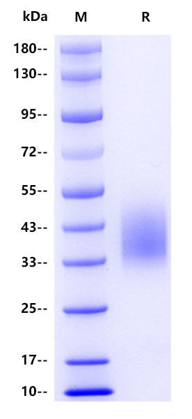 Human CD16b, His tag