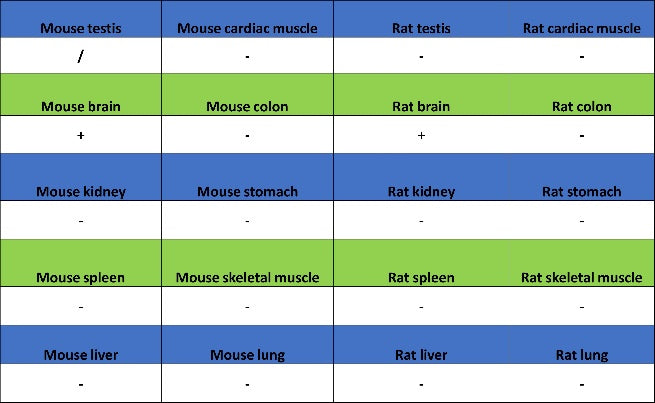 Choline Acetyltransferase/ChAT Recombinant Rabbit mAb (S-2561-17)
