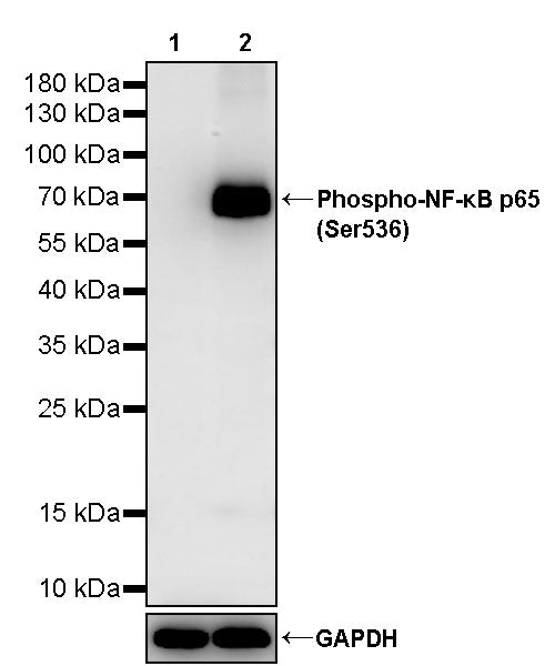 Phospho-NF-κB p65 (Ser536) Recombinant Rabbit mAb (S-3597)