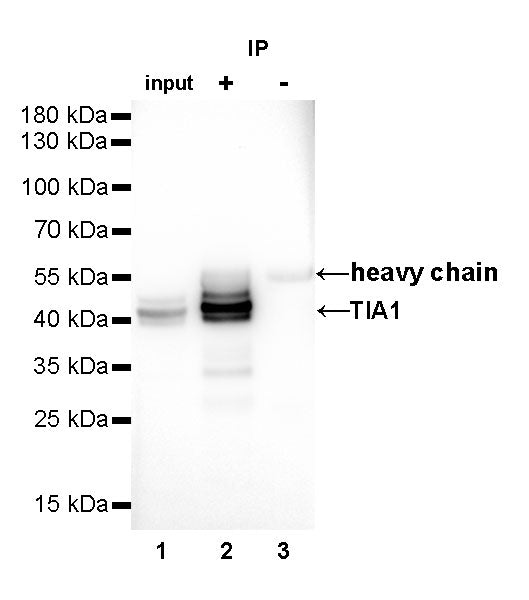 TIA1 Recombinant Rabbit mAb (S-R026)