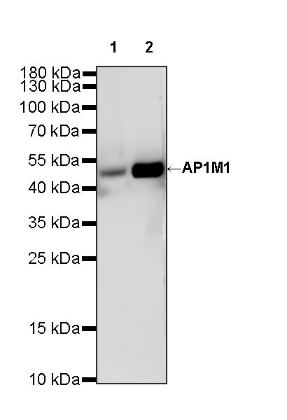 AP1M1 Recombinant Rabbit mAb (S-4593-28)