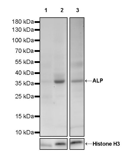 ALP Recombinant Rabbit mAb (S-2786-41)