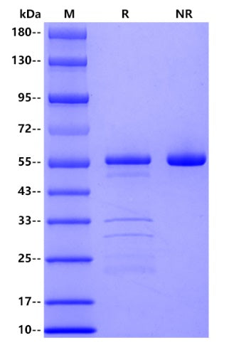 Canine Pancreatic lipase, His tag