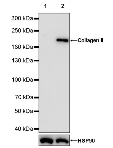 Collagen II Recombinant Rabbit mAb (S-1853-161)
