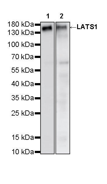 LATS1 Mouse mAb