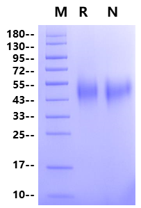 CEACAM-5/CD66e (499-685) His Tag Protein, Human