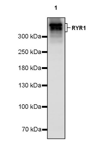 RYR1 Recombinant Rabbit mAb (S-2026-22)