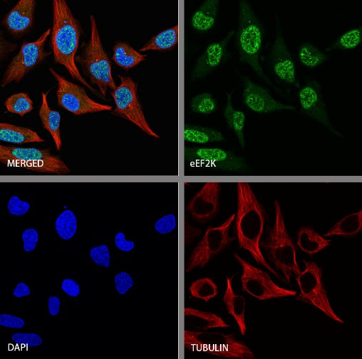 eEF2K Rabbit Polyclonal Antibody