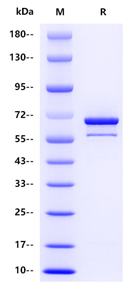 Influenza B virus NP(strain B/Victoria/2/1987), His tag