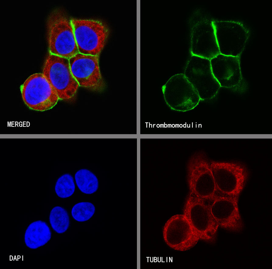 Thrombomodulin Recombinant Rabbit mAb (SDT-153-89)
