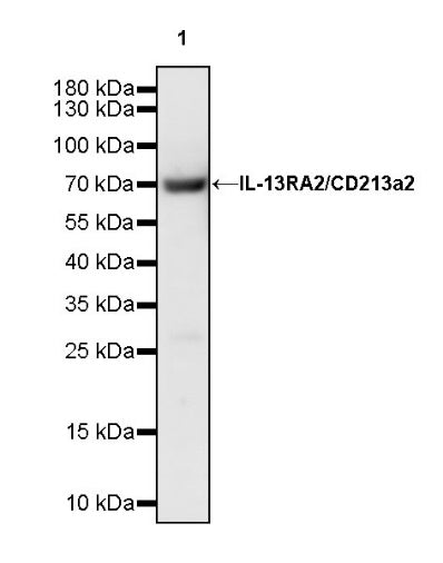 IL-13RA2/CD213a2 Rabbit Polyclonal Antibody