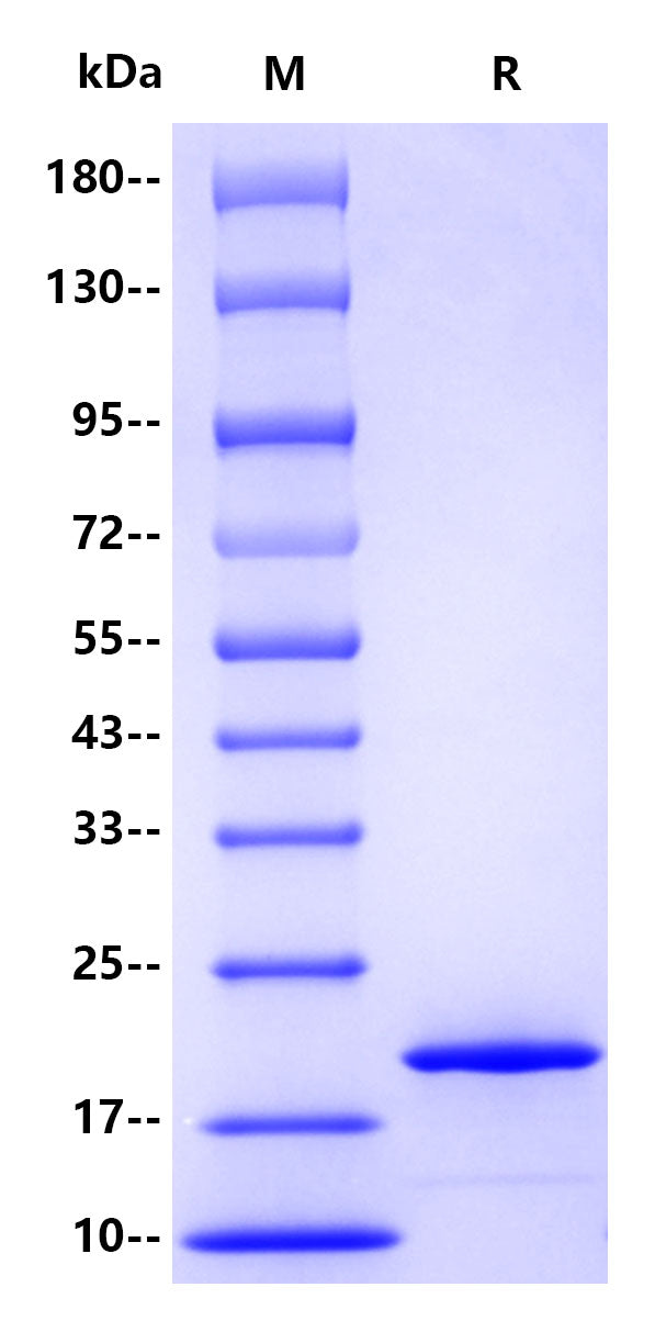 α-synuclein His tag Protein, Human