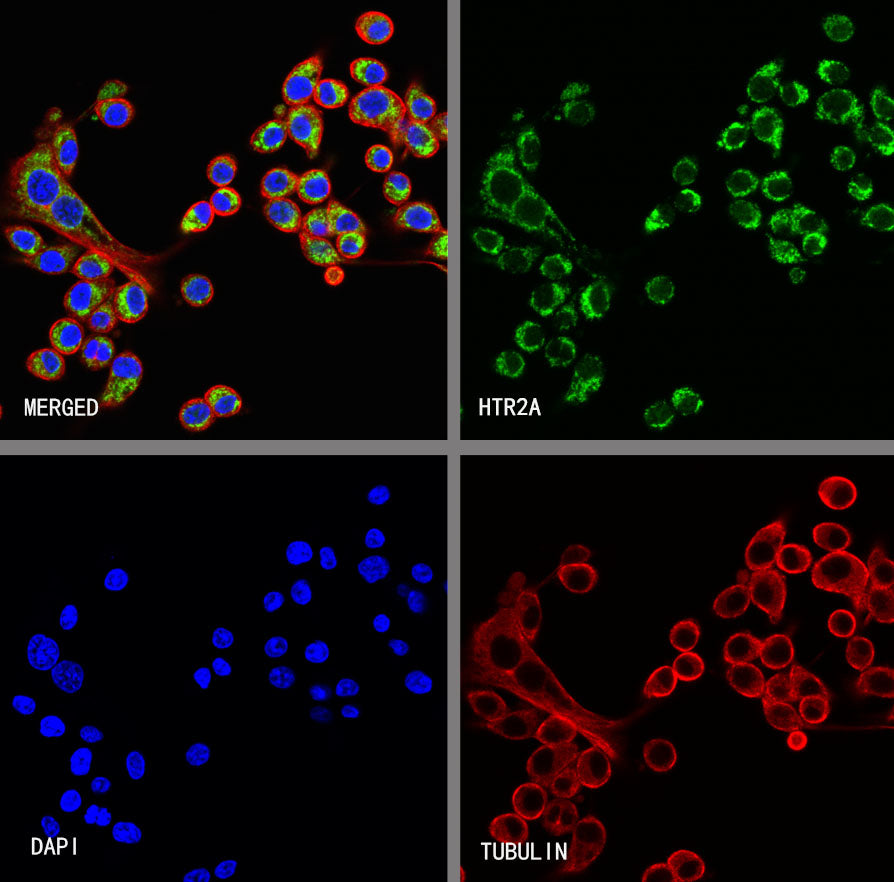 HTR2A Recombinant Rabbit mAb (S-4426-14)