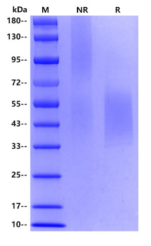 Human CD44, His tag