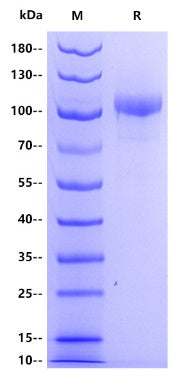 Human Thyroid peroxidase Protein, His Tag