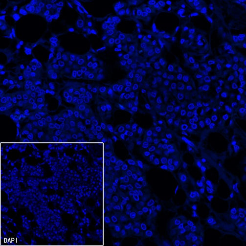 PAP Recombinant Rabbit mAb (SDT-702-140)