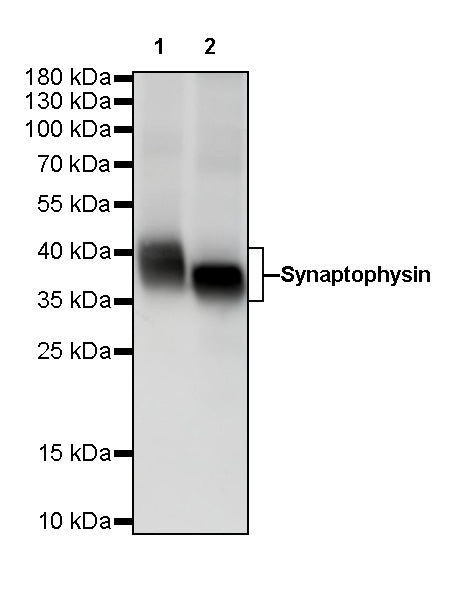 Synaptophysin Recombinant Rabbit mAb (SDT-137-21)