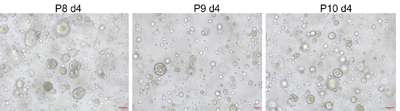 R-Spondin1/RSPO1 Protein, Human类器官培养专用