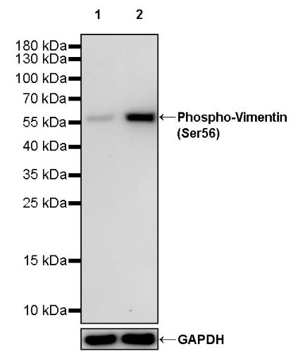 Phospho-Vimentin (Ser56) Recombinant Rabbit mAb (S-2135-5)